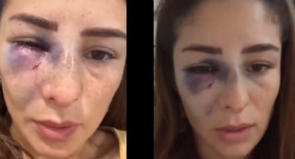 Daniela López Mejía exhibe lesiones y denuncia al padre de su hija por violencia familiar