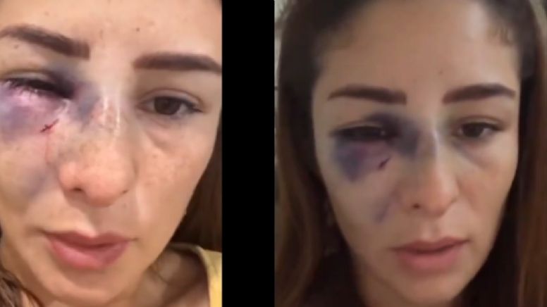 Daniela López Mejía exhibe lesiones y denuncia al padre de su hija por violencia familiar