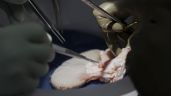 Cirujanos trasplantan riñón de cerdo a un hombre con muerte cerebral en Nueva York
