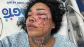 Reportan grave a Paolita Suárez de Las Perdidas en el hospital; la golpeó su novio