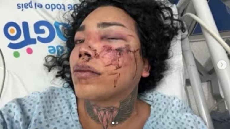 Reportan grave a Paolita Suárez de Las Perdidas en el hospital; la golpeó su novio