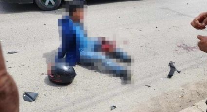 Sufre motociclista lesión grave tras chocar contra colectiva en Huejutla